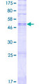 OR14I1 Protein - 12.5% SDS-PAGE of human OR5BU1 stained with Coomassie Blue