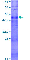 OR14J1 Protein - 12.5% SDS-PAGE of human OR5U1 stained with Coomassie Blue
