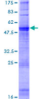 OR1A1 Protein - 12.5% SDS-PAGE of human OR1A1 stained with Coomassie Blue