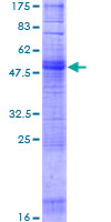 OR1A2 Protein - 12.5% SDS-PAGE of human OR1A2 stained with Coomassie Blue