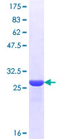 OR1I1 Protein - 12.5% SDS-PAGE Stained with Coomassie Blue.