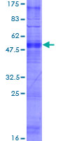 OR1N1 Protein - 12.5% SDS-PAGE of human OR1N1 stained with Coomassie Blue