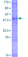 OR1Q1 Protein - 12.5% SDS-PAGE of human OR1Q1 stained with Coomassie Blue