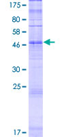 OR2A1 Protein - 12.5% SDS-PAGE of human OR2A1 stained with Coomassie Blue