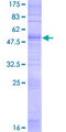 OR2B6 Protein - 12.5% SDS-PAGE of human OR2B6 stained with Coomassie Blue