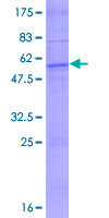 OR2C1 Protein - 12.5% SDS-PAGE of human OR2C1 stained with Coomassie Blue