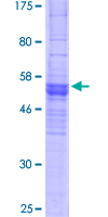 OR2C3 Protein - 12.5% SDS-PAGE of human OR2C3 stained with Coomassie Blue