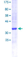 OR2C3 Protein - 12.5% SDS-PAGE Stained with Coomassie Blue.