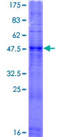 OR2F1 Protein - 12.5% SDS-PAGE of human OR2F1 stained with Coomassie Blue