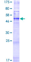 OR2G2 Protein - 12.5% SDS-PAGE of human OR2G2 stained with Coomassie Blue