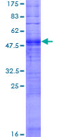 OR2G3 Protein - 12.5% SDS-PAGE of human OR2G3 stained with Coomassie Blue