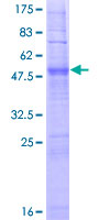 OR2J2 Protein - 12.5% SDS-PAGE of human OR2J2 stained with Coomassie Blue