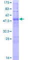 OR2J2 Protein - 12.5% SDS-PAGE of human OR2J2 stained with Coomassie Blue