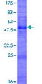 OR2S2 Protein - 12.5% SDS-PAGE of human OR2S2 stained with Coomassie Blue