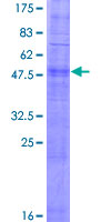 OR2T2 Protein - 12.5% SDS-PAGE of human OR2T2 stained with Coomassie Blue