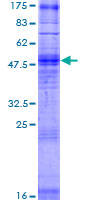 OR2T27 Protein - 12.5% SDS-PAGE of human OR2T27 stained with Coomassie Blue