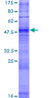OR2T35 Protein - 12.5% SDS-PAGE of human OR2T35 stained with Coomassie Blue