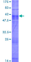 OR2T4 Protein - 12.5% SDS-PAGE of human OR2T4 stained with Coomassie Blue