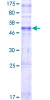 OR2T8 Protein - 12.5% SDS-PAGE of human OR2T8 stained with Coomassie Blue