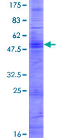 OR2W1 Protein - 12.5% SDS-PAGE of human OR2W1 stained with Coomassie Blue