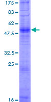 OR2W3 Protein - 12.5% SDS-PAGE of human OR2W3 stained with Coomassie Blue