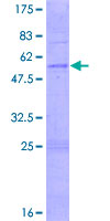 OR3A2 Protein - 12.5% SDS-PAGE of human OR3A2 stained with Coomassie Blue