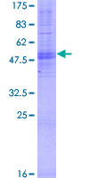 OR4B1 Protein - 12.5% SDS-PAGE of human OR4B1 stained with Coomassie Blue