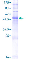 OR4C15 Protein - 12.5% SDS-PAGE of human OR4C15 stained with Coomassie Blue