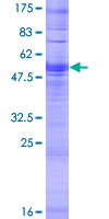 OR4D10 Protein - 12.5% SDS-PAGE of human OR4D10 stained with Coomassie Blue