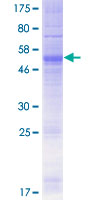 OR4D2 Protein - 12.5% SDS-PAGE of human OR4D2 stained with Coomassie Blue