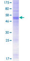 OR4D2 Protein - 12.5% SDS-PAGE of human OR4D2 stained with Coomassie Blue