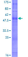 OR4D5 Protein - 12.5% SDS-PAGE of human OR4D5 stained with Coomassie Blue