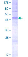 OR4E2 Protein - 12.5% SDS-PAGE of human OR4E2 stained with Coomassie Blue