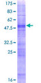 OR4K1 Protein - 12.5% SDS-PAGE of human OR4K1 stained with Coomassie Blue