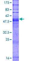 OR4K13 Protein - 12.5% SDS-PAGE of human OR4K13 stained with Coomassie Blue