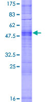 OR4K14 Protein - 12.5% SDS-PAGE of human OR4K14 stained with Coomassie Blue