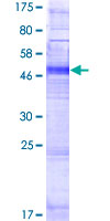 OR4K2 Protein - 12.5% SDS-PAGE of human OR4K2 stained with Coomassie Blue