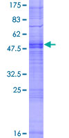 OR4K5 Protein - 12.5% SDS-PAGE of human OR4K5 stained with Coomassie Blue
