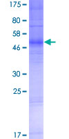 OR4N2 Protein - 12.5% SDS-PAGE of human OR4N2 stained with Coomassie Blue