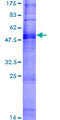 OR4N5 Protein - 12.5% SDS-PAGE of human OR4N5 stained with Coomassie Blue