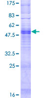 OR4P4 Protein - 12.5% SDS-PAGE of human OR4P4 stained with Coomassie Blue