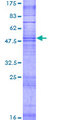 OR4X1 Protein - 12.5% SDS-PAGE of human OR4X1 stained with Coomassie Blue