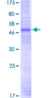OR51E1 Protein - 12.5% SDS-PAGE of human OR51E1 stained with Coomassie Blue