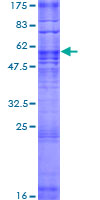 OR51F2 Protein - 12.5% SDS-PAGE of human OR51F2 stained with Coomassie Blue