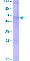 OR51G1 Protein - 12.5% SDS-PAGE of human OR51G1 stained with Coomassie Blue