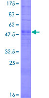 OR51G2 Protein - 12.5% SDS-PAGE of human OR51G2 stained with Coomassie Blue