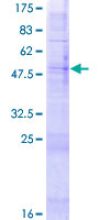 OR52B6 Protein - 12.5% SDS-PAGE of human OR52B6 stained with Coomassie Blue