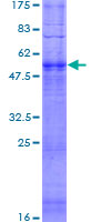 OR52D1 Protein - 12.5% SDS-PAGE of human OR52D1 stained with Coomassie Blue