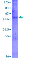 OR52E2 Protein - 12.5% SDS-PAGE of human OR52E2 stained with Coomassie Blue