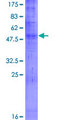 OR52E2 Protein - 12.5% SDS-PAGE of human OR52E2 stained with Coomassie Blue